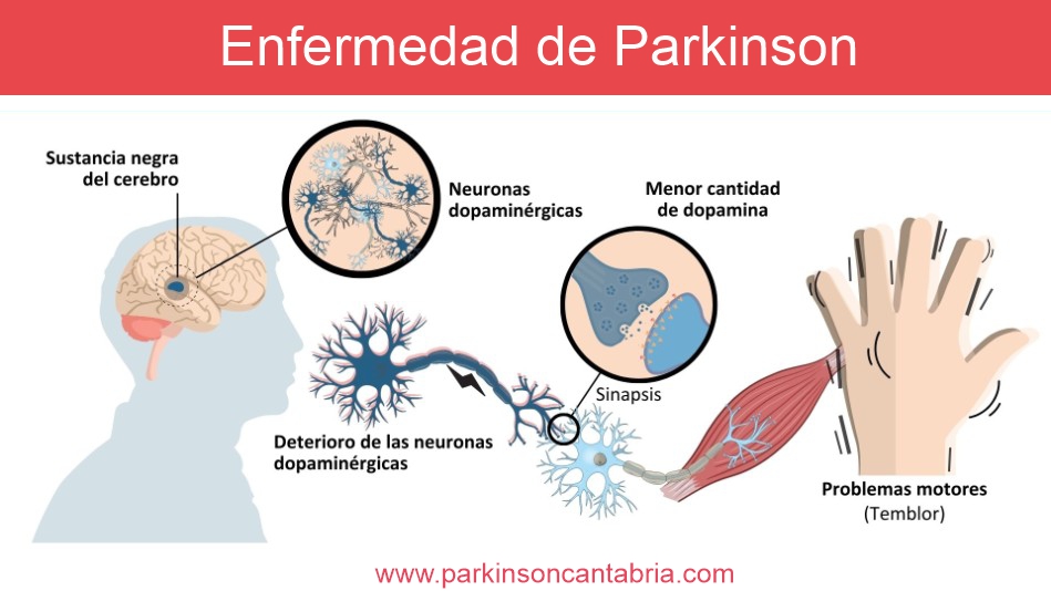 Sesión de rehabilitación y trabajo guiado